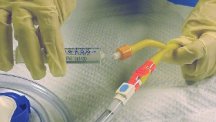 holding the catheter in place, attach the pre-filled syringe in the kit to the 